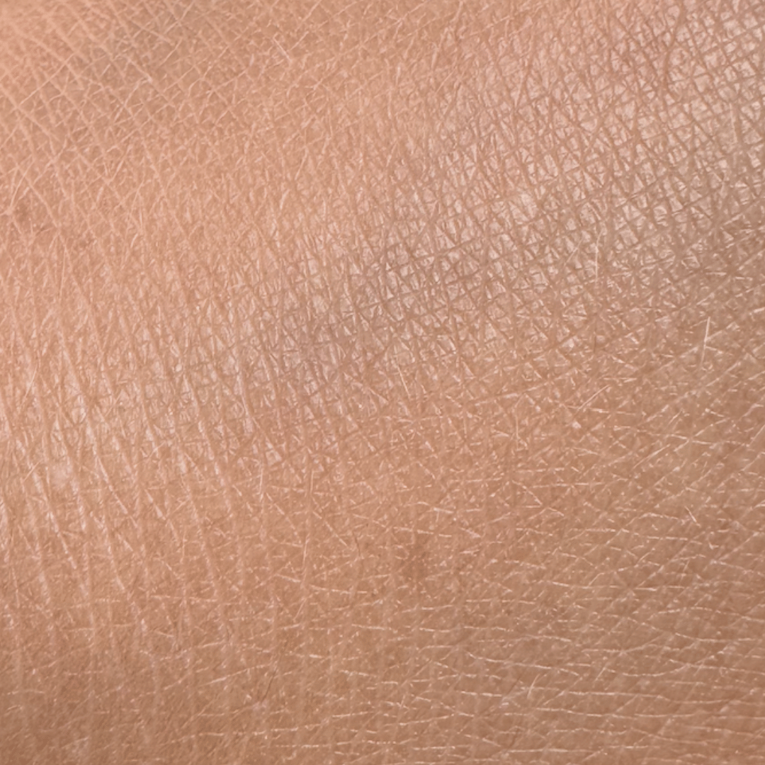 Peau en gros plan avant l’application du sérum