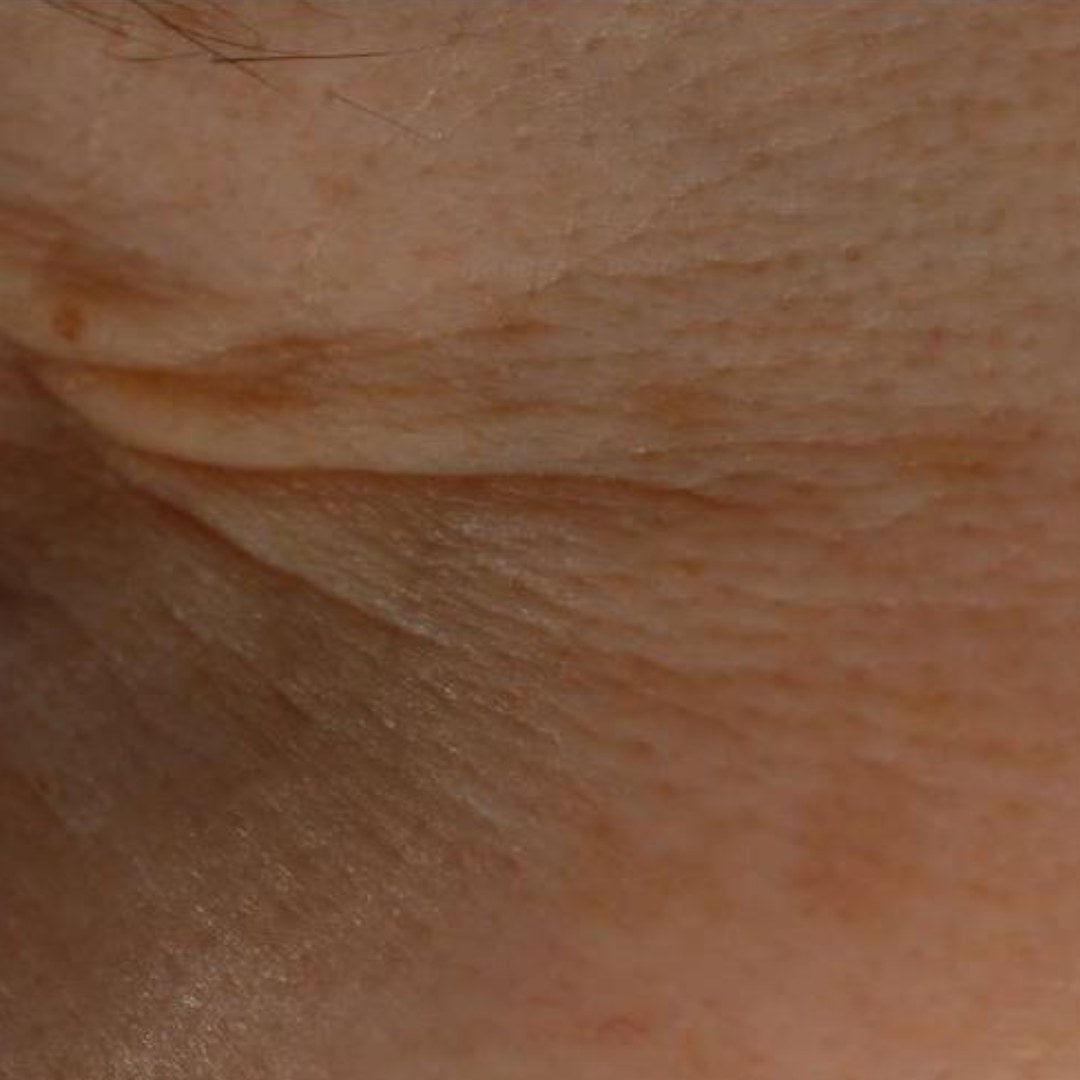 Gros plan de rides de la peau avant utilisation