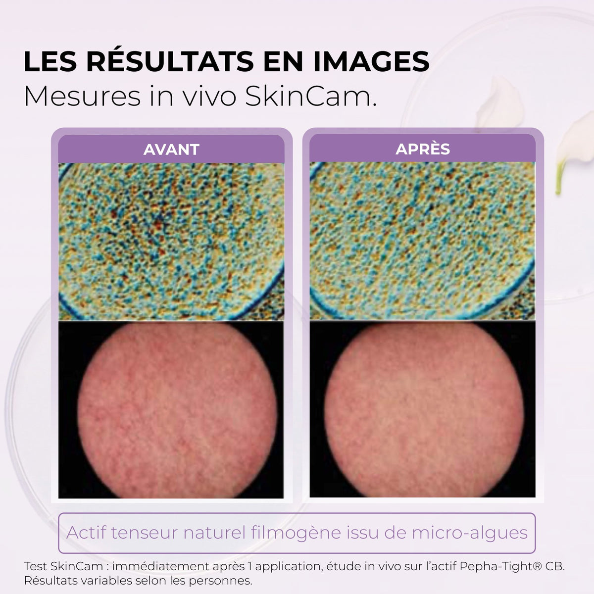 Les résultats en images, mesures in vivo SkinCam : avant et après. Actif tenseur naturel filmogène issu de micro-algues. Test SkinCam immédiatement après 1 application, étude in vivo sur l’actif Pepha-Tight CB. Résultats variables selon les personnes.