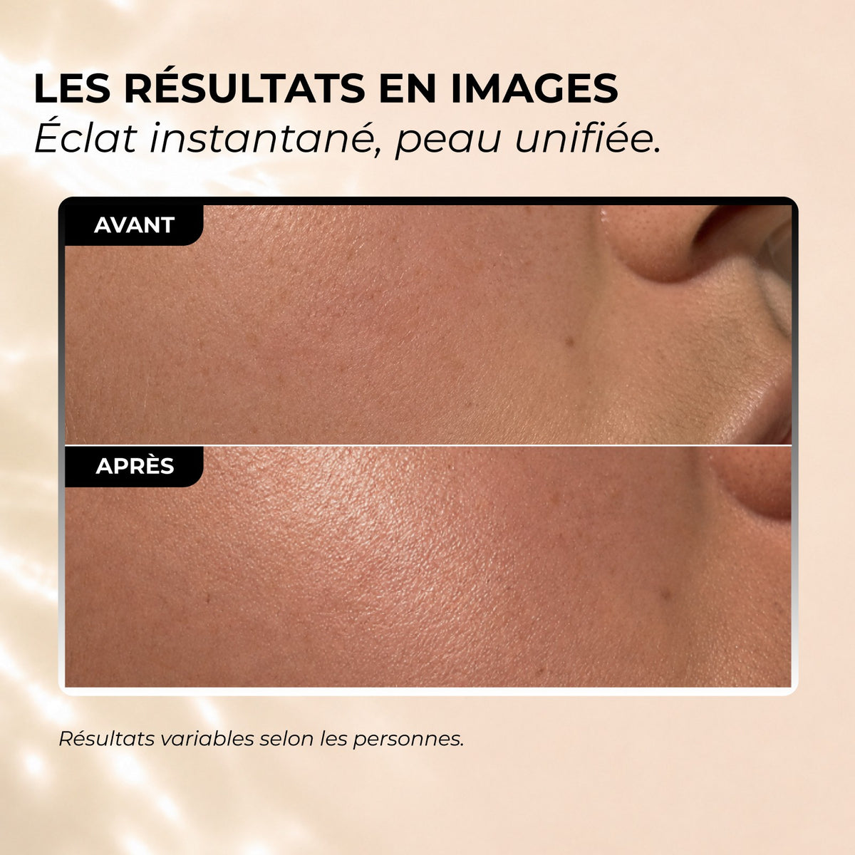 Les résultats en images : éclat instantané, peau unifiée. Gros plan de la joue avant et après. Résultats variables selon les personnes.